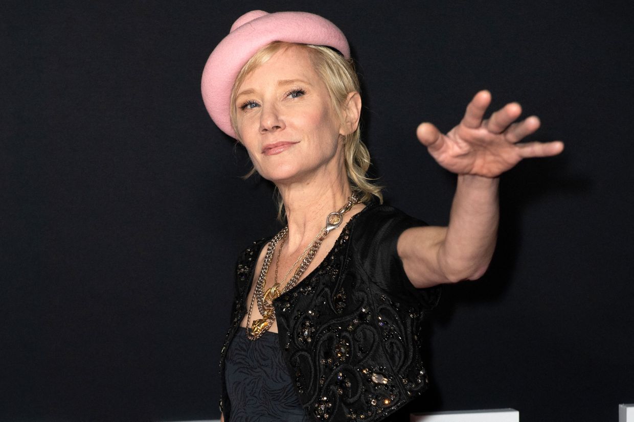 Rep Claims That After Hitting A House With A Car, Actress Anne Heche Is In A Coma